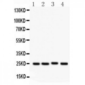SOCS3  Antibody