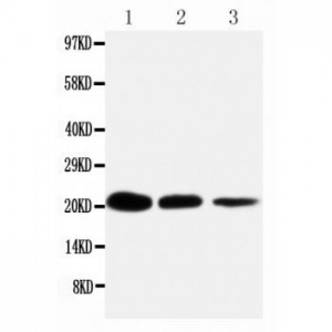 TNFRSF1A Antibody