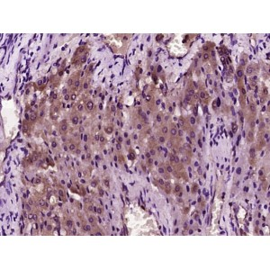 HEPCIDIN 25 POLYCLONAL ANTIBODY