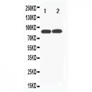 Transferrin Receptor 2 Antibody