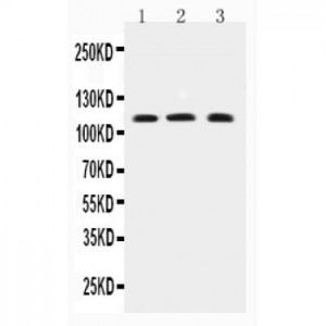 TRPC4 Antibody