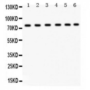 TRPV5  Antibody