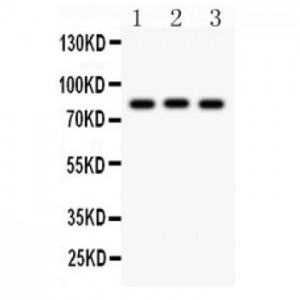 TRPV6 Antibody