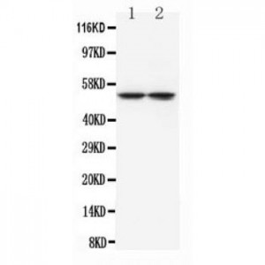Tryptophan Hydroxylase Antibody (monoclonal)