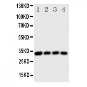UCP1 Antibody