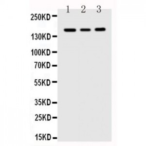VEGF Receptor 1 Antibody