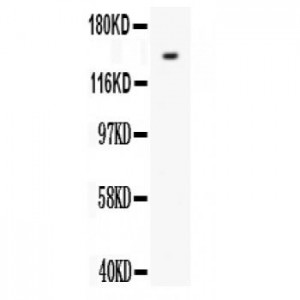 VEGF Receptor 1 Antibody