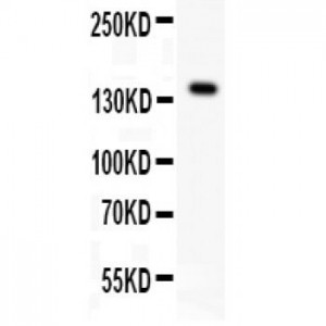 VEGF Receptor 1 Antibody