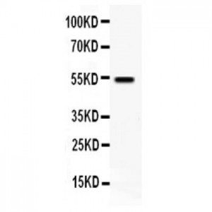 VIP Receptor 1 Antibody