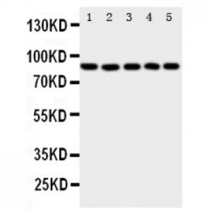 5 Lipoxygenase Antibody