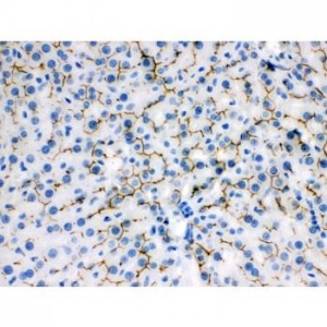 ABCB11  Antibody