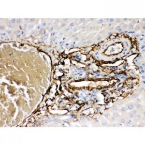 ABCB4  Antibody